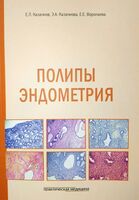Полипы эндометрия